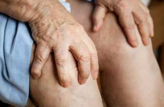Arthritis Guide